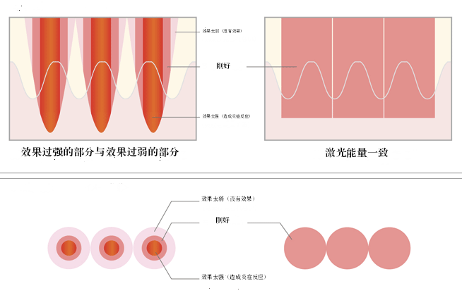 皮膚断面イメージ図